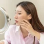 Bolehkah Melasma Dilaser?