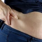 8 Penyebab Perut Kembung dan Kentut
